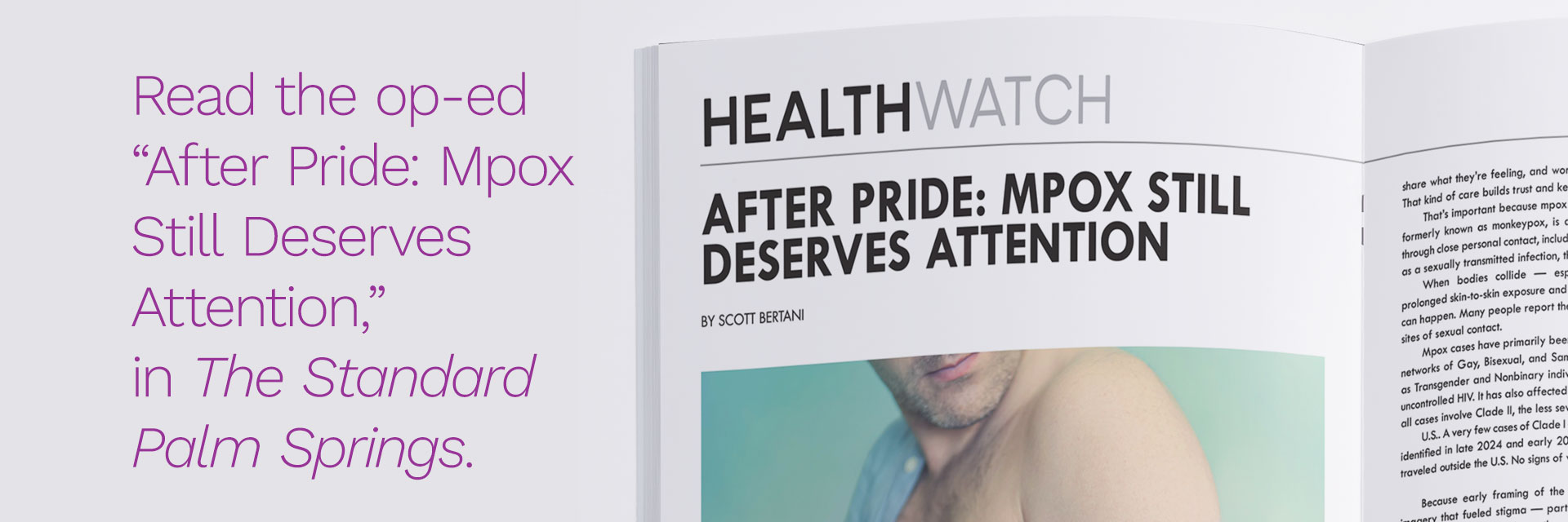 Mpox Still Deserves Attention.